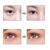 LuckyFine Multi-function Heated Sonic Eye Massager Anti-aging Galvanic Wand Anions Import Rechargeable