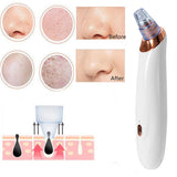 USB Electric Blackhead Suction Pore Remover Vacuum Acne Cleanser Skin Care