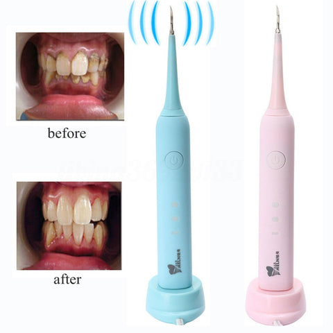 Electric Teeth Calculus Stain Removal Household Portable Dental Calculus Removal